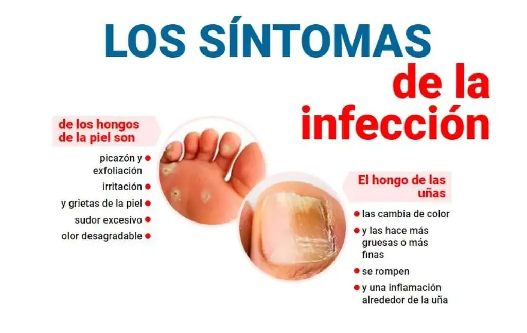 Foot Trooper México – spray antifúngico para pies